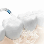 دستگاه شست و شوی دهان و دندان شیائومی MEO705 - تصویر 3